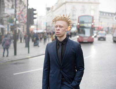 英白化病男孩，成功逆襲成時(shí)尚模特