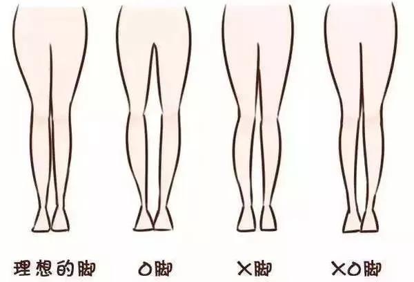 小粗腿、O型腿、X型腿？腿型矯正操拯救你的難看腿型!